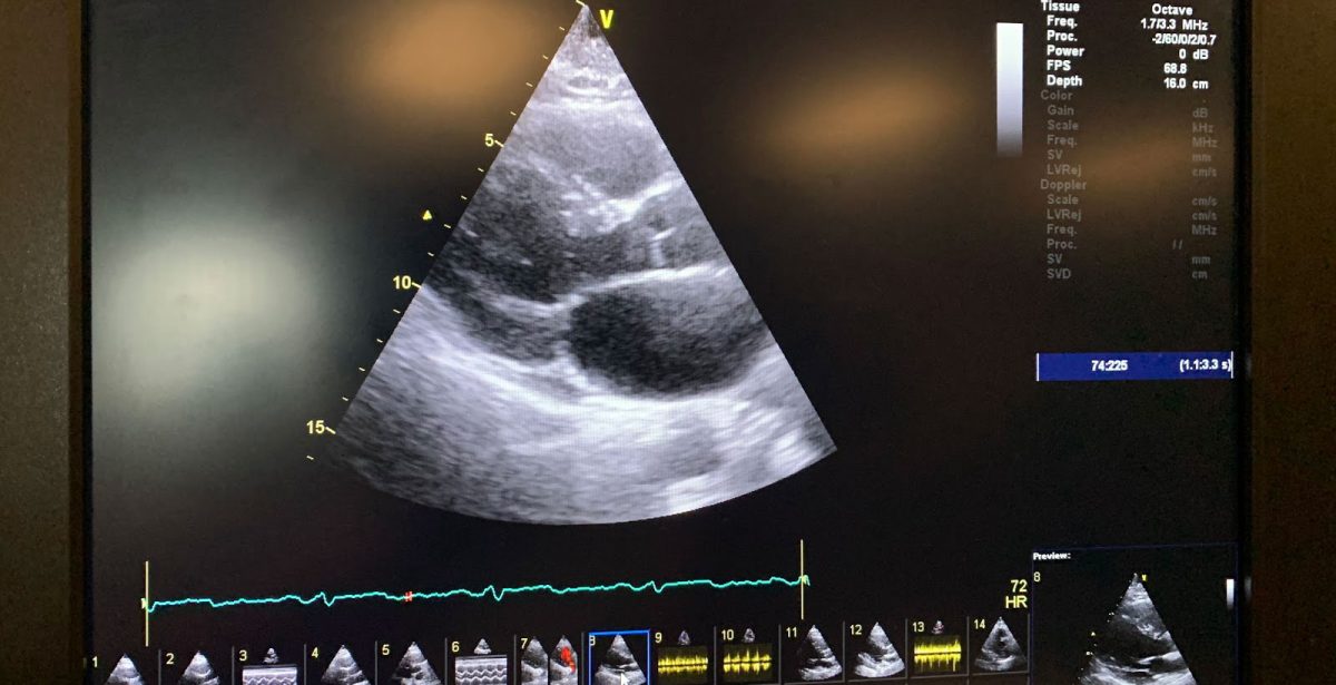 Meet a Cardiac Sonography Student